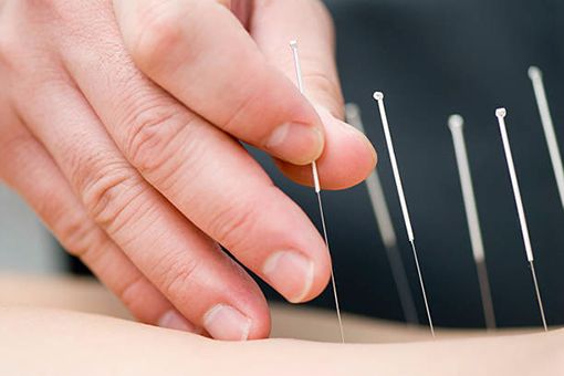 Acupuncture Clinics in hyderabad